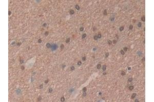 Detection of mTOR in Human Brain Tissue using Polyclonal Antibody to Serine/threonine-protein kinase mTOR (mTOR)