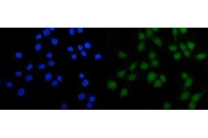 IF analysis of FOXJ1 using anti-FOXJ1 antibody (ABIN7601015). (FOXJ1 anticorps  (AA 27-405))