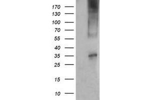 Western Blotting (WB) image for anti-T-cell surface glycoprotein CD1c (CD1C) antibody (ABIN2670660) (CD1c anticorps)