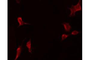 ABIN6277686 staining COLO205 by IF/ICC.