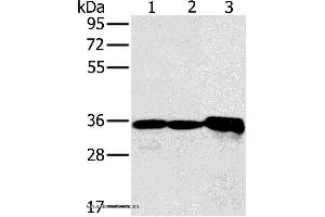Western blot analysis of Mouse kidney tissue and Jurkat cell, mouse heart tissue, using NDUFA9 Polyclonal Antibody at dilution of 1:400 (NDUFA9 anticorps)