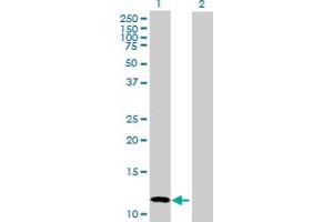 Western Blot analysis of CALCB expression in transfected 293T cell line by CALCB MaxPab polyclonal antibody. (CALCB anticorps  (AA 1-127))