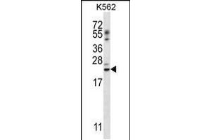 Western blot analysis in K562 cell line lysates (35ug/lane). (PSORS1C1 anticorps  (N-Term))