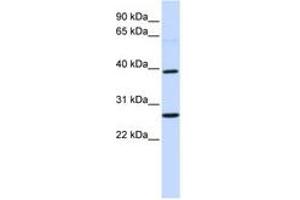 Image no. 1 for anti-Wingless-Type MMTV Integration Site Family, Member 16 (WNT16) (AA 252-301) antibody (ABIN6740724)