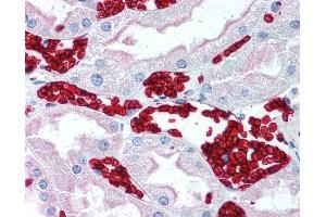 Anti-GYPA / Glycophorin A antibody IHC of human kidney, red blood cells. (CD235ab anticorps)