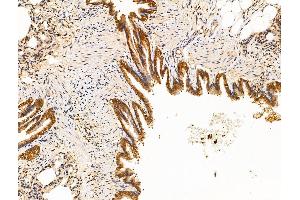 ABIN7094623 and ABIN7098673 at 1/100 staining Rat lung tissue by IHC-P. (MTDH anticorps  (C-Term))