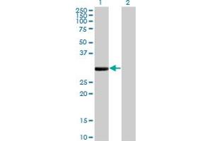 Western Blot analysis of FCN1 expression in transfected 293T cell line by FCN1 monoclonal antibody (M06), clone 2B7. (FCN1 anticorps  (AA 201-300))