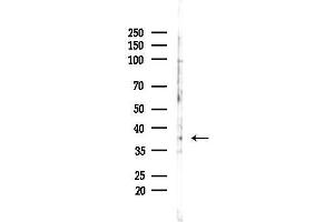 anti-NADH Dehydrogenase (Ubiquinone) 1 alpha Subcomplex, 9, 39kDa (NDUFA9) (Internal Region) antibody