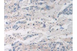 Used in DAB staining on fromalin fixed paraffin- embedded glioma tissue (Factor VIII anticorps  (AA 1887-2044))