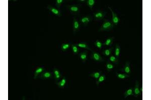Immunofluorescence analysis of A549 cells using APEX1 antibody. (APEX1 anticorps  (AA 1-318))