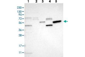 Western blot analysis of Lane 1: RT-4, Lane 2: U-251 MG, Lane 3: Human Plasma, Lane 4: Liver, Lane 5: Tonsil with SLC41A1 polyclonal antibody . (SLC41A1 anticorps)