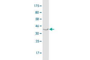 Western Blot detection against Immunogen (37.