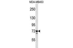 TMPO Antibody (N-term) western blot analysis in MDA-MB453 cell line lysates (35 µg/lane). (Thymopoietin anticorps  (N-Term))