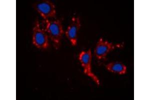 Immunofluorescent analysis of RPL39 staining in HepG2 cells. (RPL39 anticorps  (N-Term))