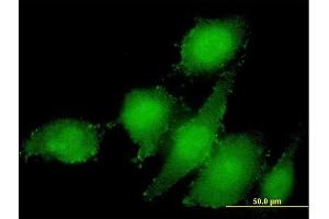 Immunofluorescence of monoclonal antibody to STAMBP on HeLa cell. (STAMBP anticorps  (AA 1-424))