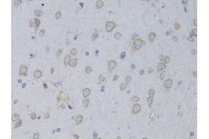 Immunohistochemistry of paraffin-embedded rat brain using GARS antibody (ABIN1876623) at dilution of 1:100 (40x lens). (GARS anticorps)