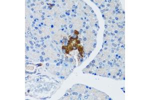 Immunohistochemistry of paraffin-embedded rat pancreatic islet using TSC1 antibody (ABIN6133755, ABIN6149609, ABIN6149610 and ABIN6213968) at dilution of 1:200 (40x lens).