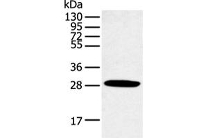 Western blot analysis of Human normal lung tissue using CLDN25 Polyclonal Antibody at dilution of 1:250 (CLDN25 anticorps)