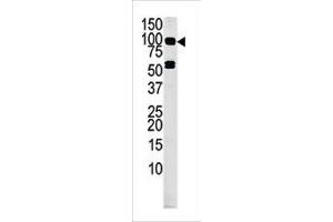 Western blot analysis of anti-RK4 Pab (ABIN391222 and ABIN2841295) in mouse liver tissue lysate (35 μg/lane).