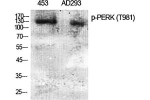 Western Blot analysis of 453(1), AD293(2), diluted at 1:2000. (PERK anticorps  (pThr981))