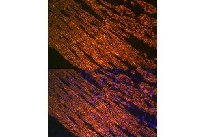 Immunofluorescence analysis of smooth muscle of human colon carcinoma using α-Smooth Muscle Actin  Rabbit mAb (ABIN7265392) at dilution of 1:100 (40x lens). (Smooth Muscle Actin anticorps)