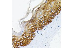 Immunohistochemistry of paraffin-embedded mouse skin using Cytokeratin 14 (KRT14) (KRT14) Rabbit mAb (ABIN7268091) at dilution of 1:100 (40x lens).