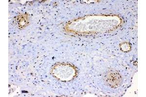 IHC testing of FFPE human placenta tissue with VEGFR2 antibody at 1ug/ml.