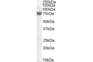 Image no. 1 for anti-Fem-1 Homolog A (FEM1A) (C-Term) antibody (ABIN375131) (FEM1A anticorps  (C-Term))