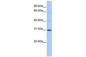 C1ORF184 antibody used at 1 ug/ml to detect target protein. (METTL11B anticorps  (C-Term))