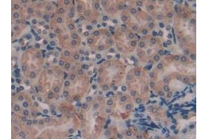 DAB staining on IHC-P; Samples: Mouse Kidney Tissue (AMBP anticorps  (AA 18-202))