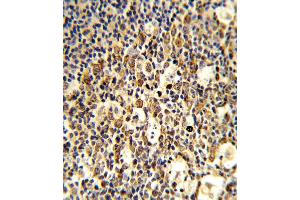 Formalin-fixed and paraffin-embedded human tonsil reacted with FCGR1B Antibody , which was peroxidase-conjugated to the secondary antibody, followed by DAB staining.
