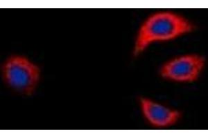 Immunofluorescent analysis of GAB1 staining in K562 cells. (GAB1 anticorps  (C-Term))