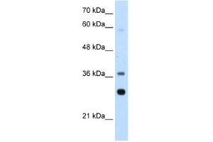 RPLP0 antibody used at 2. (RPLP0 anticorps  (Middle Region))