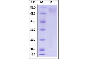 Biotinylated Human CEACAM-1, Avitag,His Tag on  under reducing (R) condition.