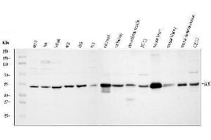 Western blot analysis of Integrin linked ILK using anti-Integrin linked ILK antibody (ABIN7602632).