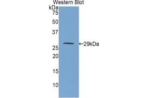 Western blot analysis of the recombinant protein. (IGF2R anticorps  (AA 1146-1363))