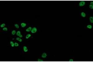 Immunofluorescence (IF) image for anti-Tumor Protein P53 (TP53) antibody (ABIN1499967) (p53 anticorps)
