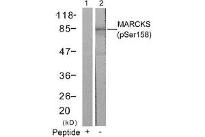 Western blot analysis of extracts from 3T3 cells using MARCKS(Phospho-Ser158) Antibody(Lane 2) and the same antibody preincubated with blocking peptide(Lane1). (MARCKS anticorps  (pSer158))