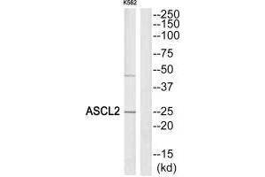 Western blot analysis of extracts from K562 cells, using ASCL2 antibody. (ASCL2 anticorps)