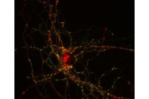 Indirect immunostaining of PFA fixed rat hippocampus neurons with anti-Nedd 4-2 (dilution 1 : 100; red) and mouse anti-synapsin 1 (, dilution 1 : 500; green). (NEDD4-2 anticorps  (AA 256-414))