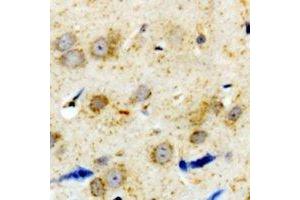 Immunohistochemical analysis of Alpha-1A Adrenergic Receptor staining in human brain formalin fixed paraffin embedded tissue section. (alpha 1 Adrenergic Receptor anticorps  (C-Term))