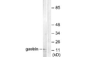 Western blot analysis of extracts from NIH/3T3 cells, using Gastrin antibody (#C0205). (Gastrin anticorps)