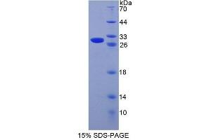 SDS-PAGE analysis of Mouse CRISP1 Protein.