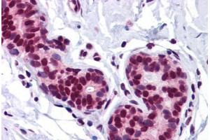 Human Breast: Formalin-Fixed, Paraffin-Embedded (FFPE)