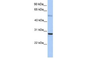 WB Suggested Anti-MXD1 Antibody Titration:  0. (MXD1 anticorps  (N-Term))