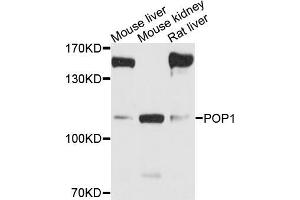 Western blot analysis of extracts of various cell lines, using POP1 antibody (ABIN5973549) at 1/1000 dilution. (POP1 anticorps)