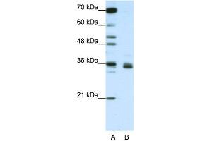 HNRNPA1L2 anticorps  (N-Term)
