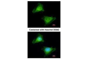 ICC/IF Image Immunofluorescence analysis of methanol-fixed HeLa, using Guanylate binding protein 3, antibody at 1:200 dilution.