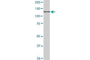 CAND1 monoclonal antibody (M05), clone 1G5. (CAND1 anticorps  (AA 1-100))