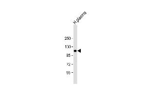 Anti-ITIH4 Antibody (C-Term) at 1:2000 dilution + human plasma lysate Lysates/proteins at 20 μg per lane. (ITIH4 anticorps  (AA 784-816))